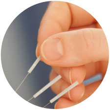 Acupuncture Treatment